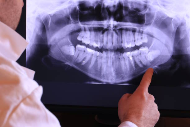 Best Knocked-Out Tooth Emergency  in Burlington, KS