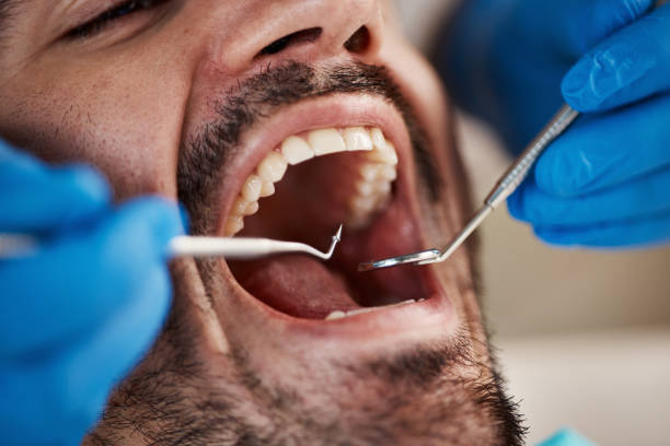 Best Root Canal Emergency Dentist  in Burlington, KS